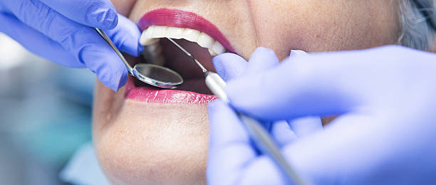 Best Emergency Gum Treatment in Westover, AL